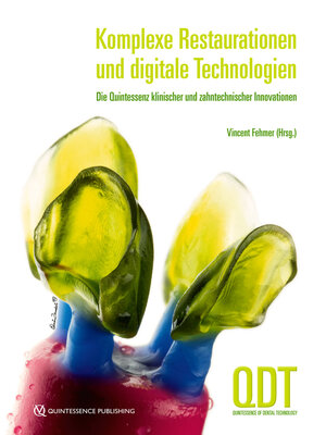 cover image of Komplexe Restaurationen und digitale Technologien